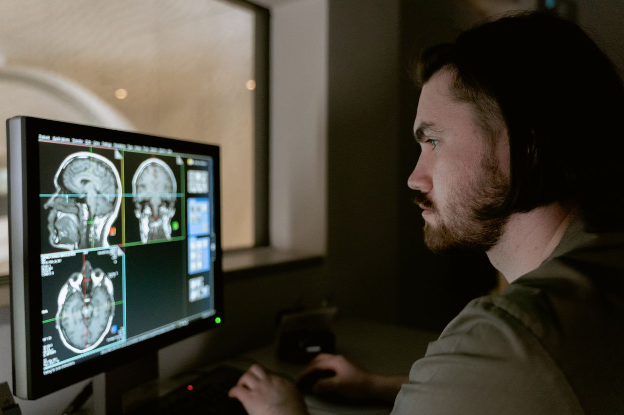 Bringing AI-Powered Natural Language Access to a Radiology Platform with MCP